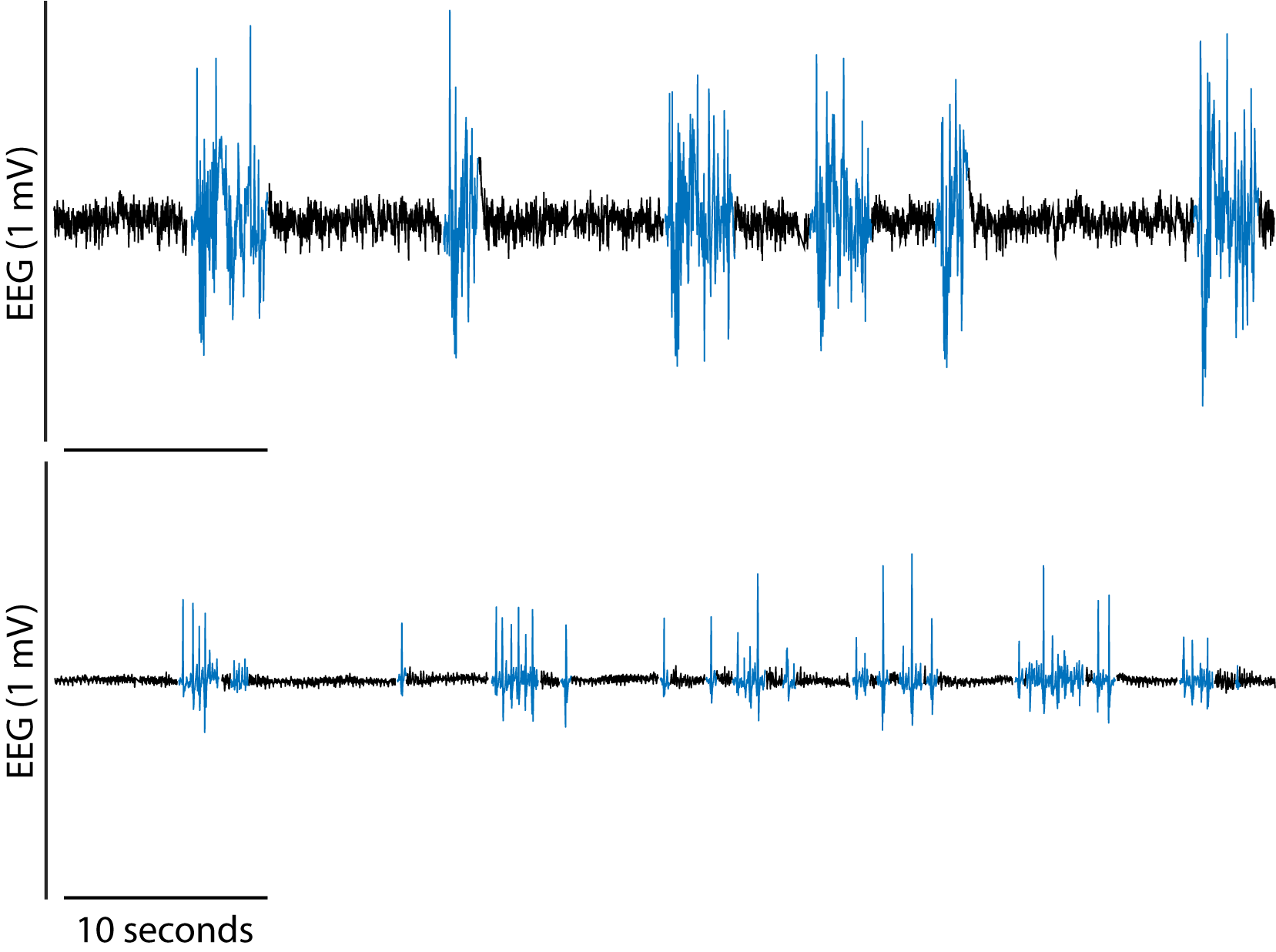EEG burst-suppression pattern induced by either sevoflurane or propofol general anesthesia.