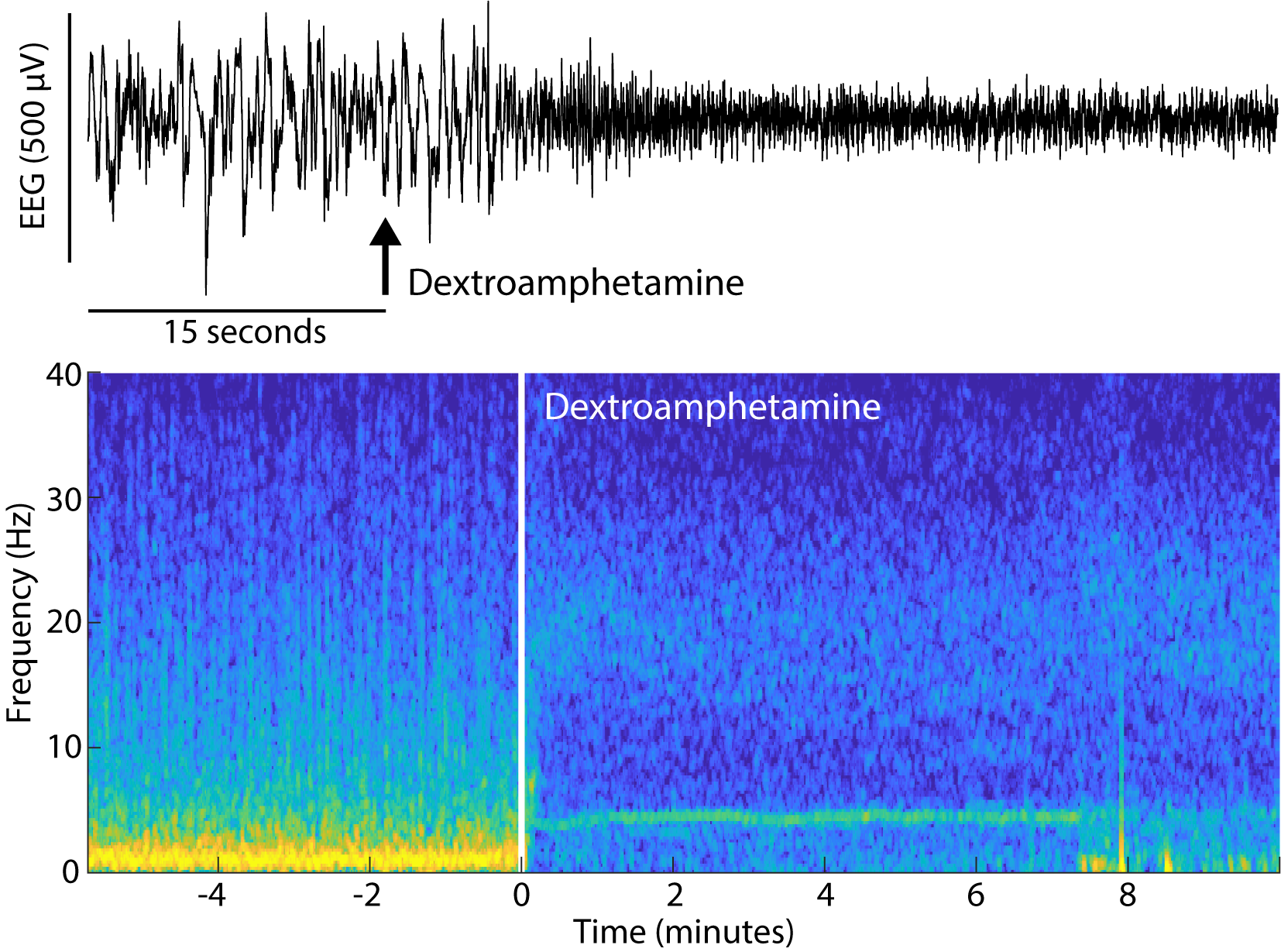 Intravenous administration of dextroamphetamine induces active emergence from sevoflurane general anesthesia in rats.